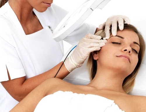 Sonde izolate, indispensabile in electroliza ( electroepilare )!